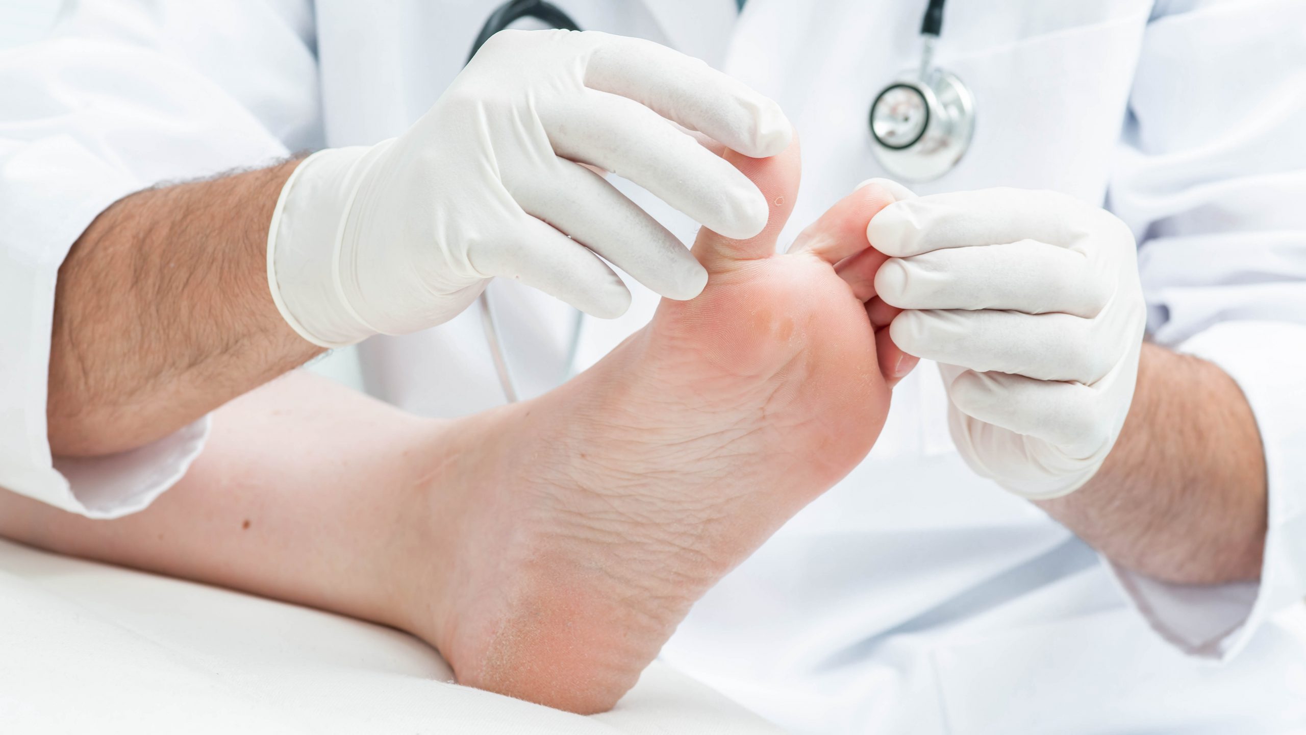 Fußfehlstellungen - Hallux valgus - Priv. Doz. Dr. Heimo Clar